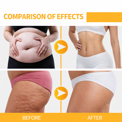 Anti-Cellulite Massage Oil